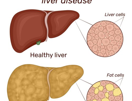 Cannabinoids and Fatty Liver Disease: Emerging Research Highlights a Growing Health Challenge for Seniors